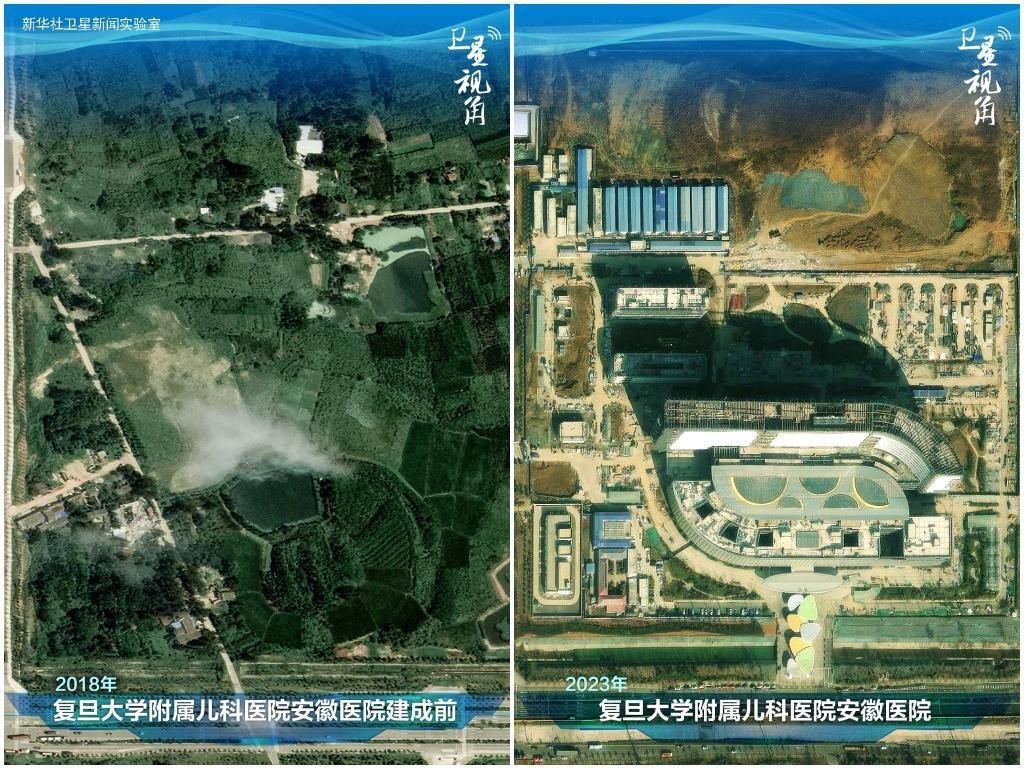 2023年與2018年相比，復(fù)旦大學(xué)附屬兒科醫(yī)院安徽醫(yī)院從一片荒地到建成投用。該項(xiàng)目是安徽省在長三角一體化高質(zhì)量發(fā)展衛(wèi)生健康領(lǐng)域的重大項(xiàng)目，也是安徽首批落地的國家區(qū)域醫(yī)療中心。